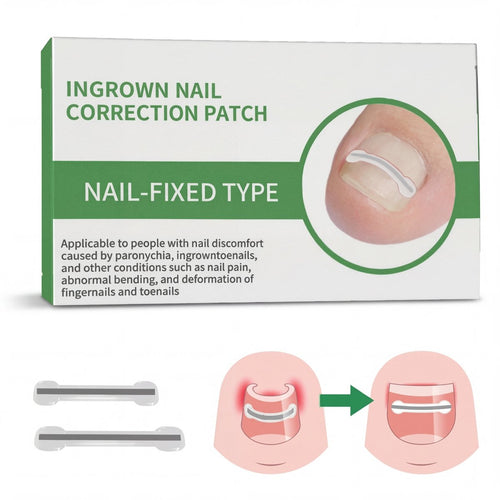 HEALO Ingrown Toenail Correction Kit - HEALO