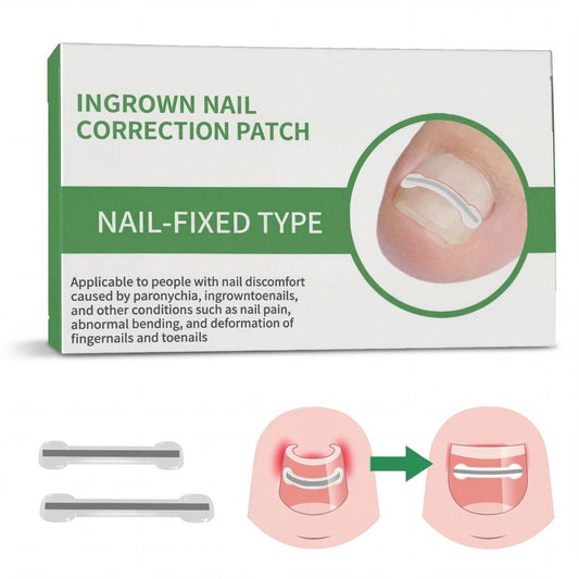 HEALO Ingrown Toenail Correction Kit - HEALO