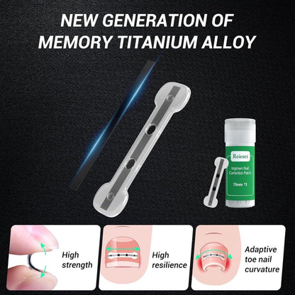 HEALO Ingrown Toenail Correction Kit - HEALO