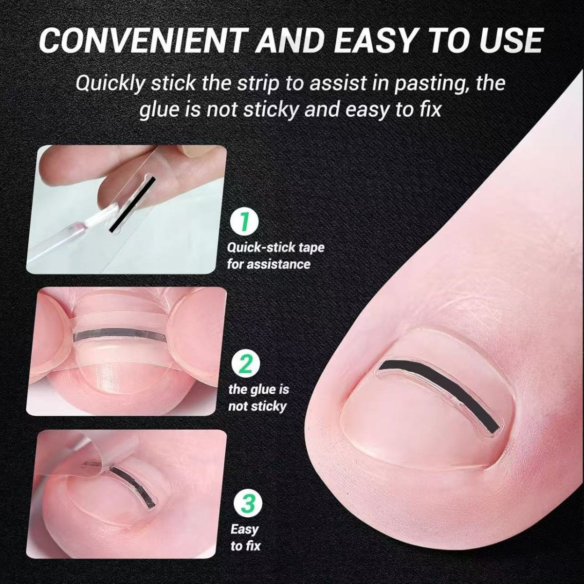 HEALO Ingrown Toenail Correction Kit - HEALO